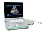 SonoStar vet ultrasound scanner UK