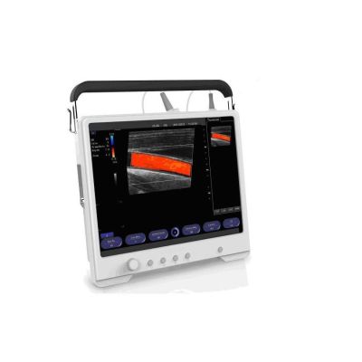 VIS SCANPAD PRO COLOUR WITH MICRO-CONVEX PROBE