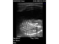 AGOUTI PREGNANCY AND IMPLICATIONS ON THE WIDER WORLD