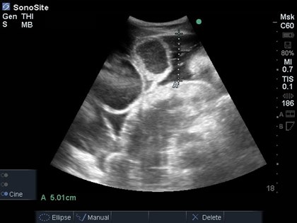 EQUINE ABDOMINAL ULTRASONOGRAPHY - WHAT WE CAN LEARN 