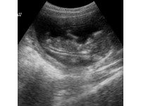 CANINE PREGNANCY AND ULTRASOUND IMAGING