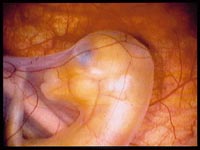 EQUINE PREGNANCY AND PHD - A GOOD MIX?