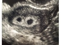 HOW TO DETECT PREGNANCY IN DAIRY CATTLE