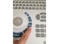 HOW TO CALCULATE GESTATIONAL AGE ON YOUR TH80V