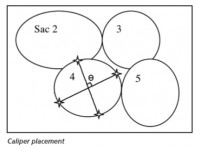 WHY DO HIGHER FREQUENCY TRANSDUCERS GIVE BETTER RESOLUTION?
