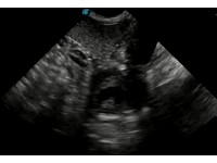 DISTINGUISHING BETWEEN GESTATION SACS AND INTESTINES