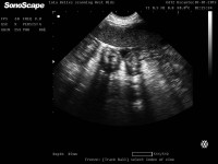 THE APPEARANCE OF ADVANCED PYOMETRA ON ULTRASOUND