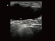Ultrasound image of a Canine Bladder taken on the Ebit 50