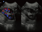 Canine Kidney B/BC Mode ultrasound image taken on the Ebit50