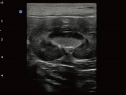 Canine Kidney ultasound image taken omn the Ebit 50
