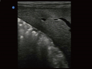 Canine Liver B-Mode ultrasound image taken on the Ebit 50