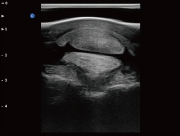 Equine Tendon ultrasound image taken on the Ebit 50