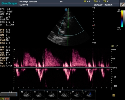 Sonoscape S9 Ultrasound